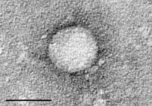 Virus hepatitis C (HCV).