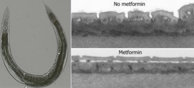 Cacing gelang yang diberi metformin menunjukkan penurunan ukuran yang sangat terbatas dan tidak ada kerutan. (Credit: Copyright Wouter De Haes)