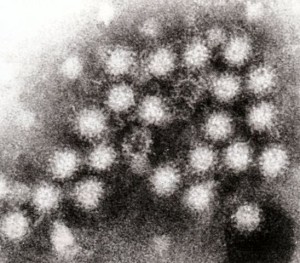 Partikel norovirus di feses. (Photo: GrahamColm)