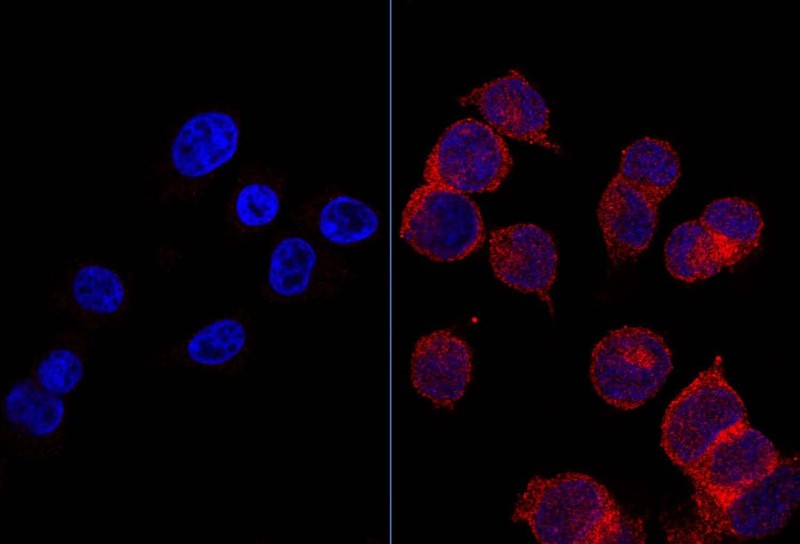 Kiri, sel-sel sehat dengan reseptor glukosa yang sedikit. Kanan, sel-sel tumor dengan glukosa dalam reseptor merah dengan jumlah yang banyak. (Credit: Image courtesy of IDIBELL-Bellvitge Biomedical Research Institute)