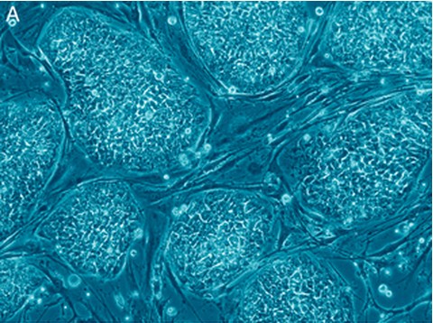 Koloni sel punca embrionik manusia yang belum terdiferensiasi. (Credit: Follow the Money – The Politics of Embryonic Stem Cell Research. Russo E, PLoS Biology Vol. 3/7/2005, e234. doi: 10.1371/journal.pbio.0030234)