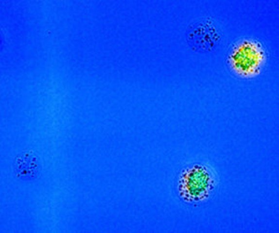 mikrograf, enzim antibakteri
