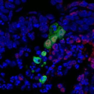 sel punca, stem cell, region-selective pluripotent stem cells