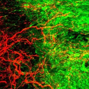 Akson saluran kortikospinalis, implan sel punca, stem cell, tulang belakang