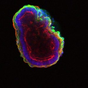 stem cell, sel punca, bola berongga